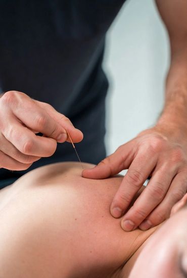 A person receives acupuncture treatment on their back.