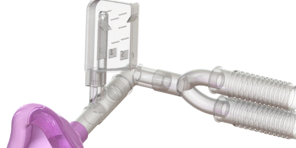 The Breathe Down Buddy inserted into an anesthesia breathing circuit