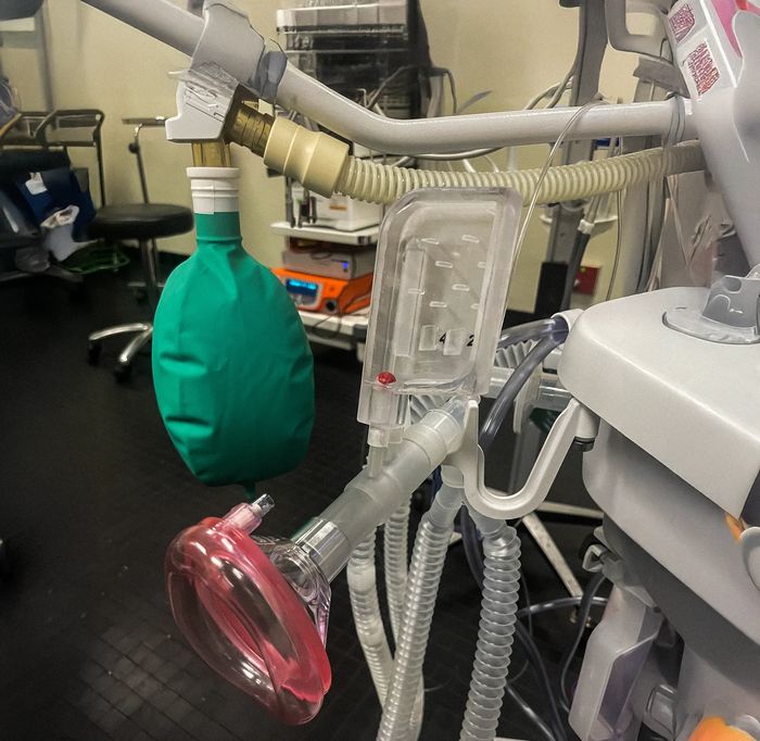 Breathe Down Buddy device hanging on the side of an anesthesia breathing machine.