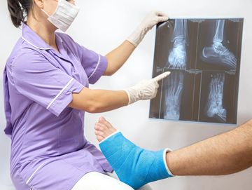 Medical professional examines foot X-rays with patient wearing blue cast.