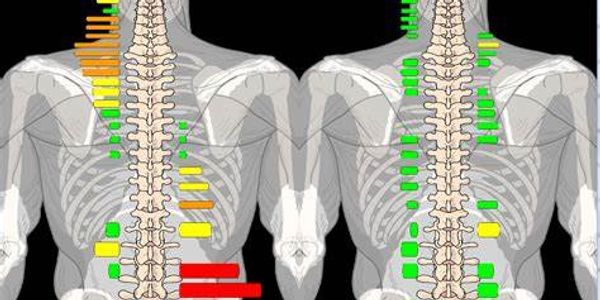 Thermography Before and After