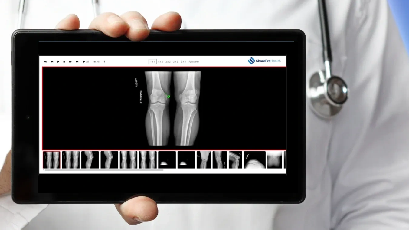 release of information company, radiology imaging, copy service, ROI services, 