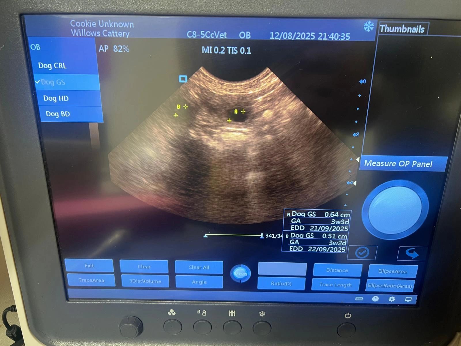 Pregnancy Ultrasound