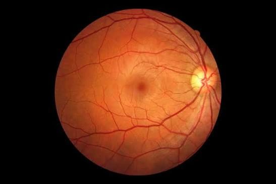 Retinal health evaluation