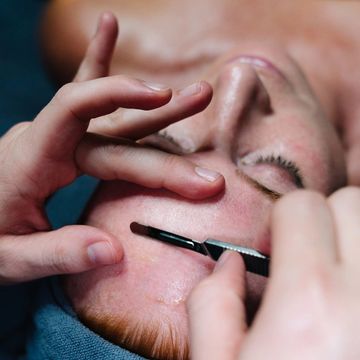 Close-up of facial treatment using a razor on a man's forehead.
