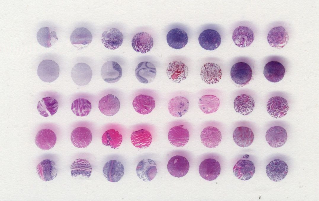 DNA/RNA Extraction from Tissue Samples