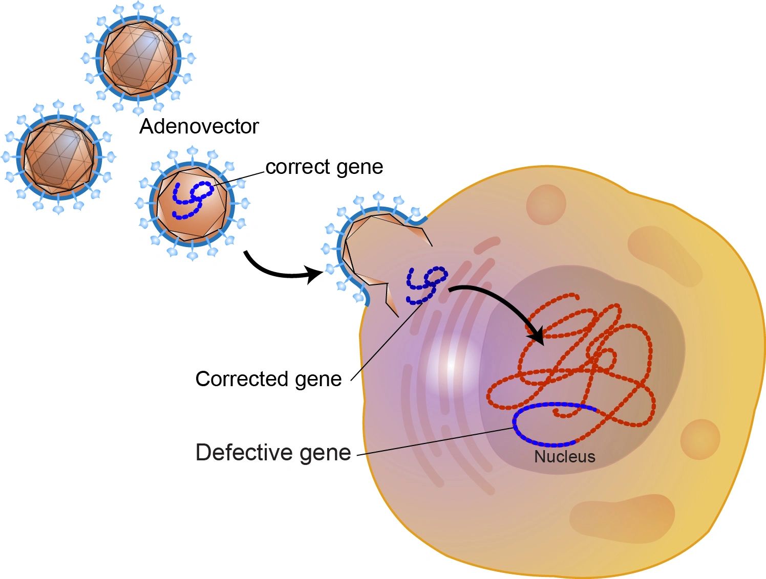 Gene Therapy Pt. 1: The Bad Beginning