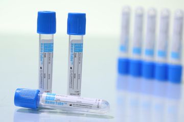 MB Plastic Industries - Disposable Labwares, Blood Collection Tube | MB ...