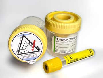 Urine Vacuum Container MB Vacuum Container urine Preservative