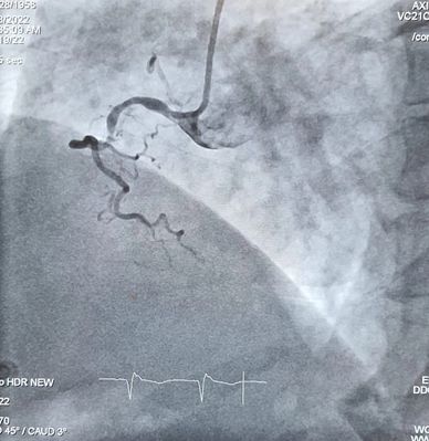 CAD