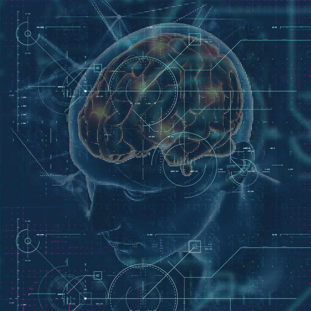 Brain Image