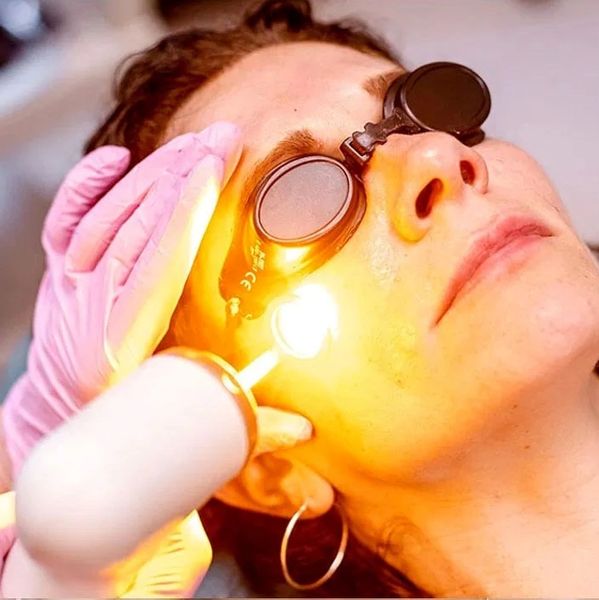 Skin laser treatment Boulder Colorado,Botox injections lafayette CO,skin care clinic boulder CO