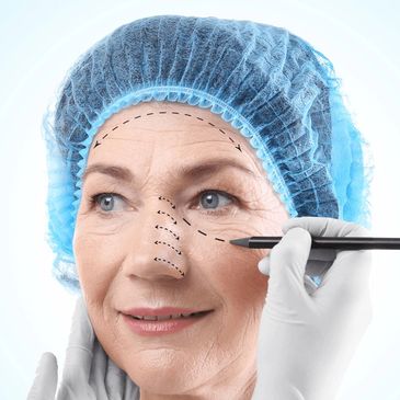 Blepharoplasty surgery