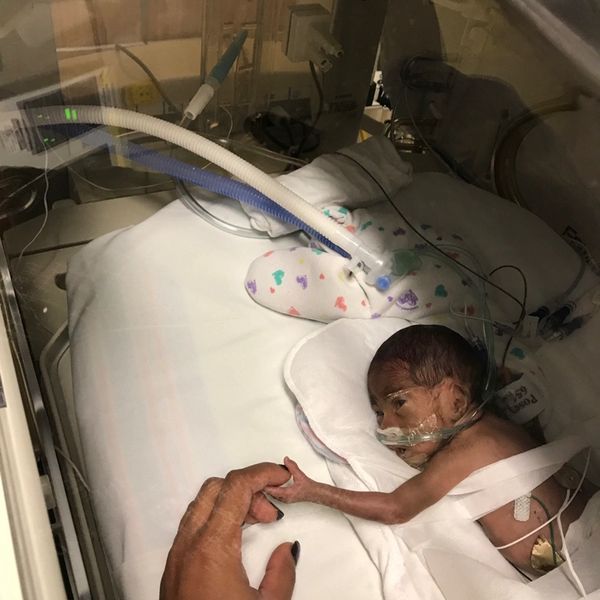 Miracle Malcolm holding mom's finger in NICU.