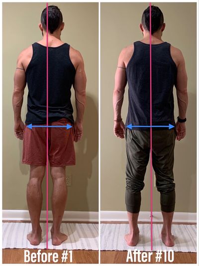 The body has shifted closer to the midline and the pelvis to the neutral position after #10  
