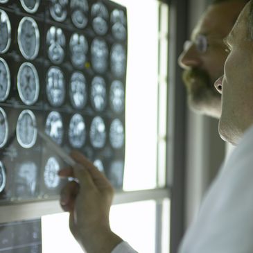 Doctors examining brain scans on a lightbox.