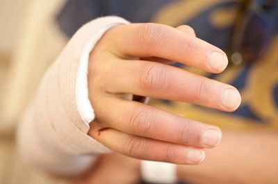 hand with braces