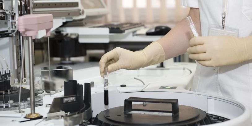 Lab technician handling blood sample in a clinical laboratory.