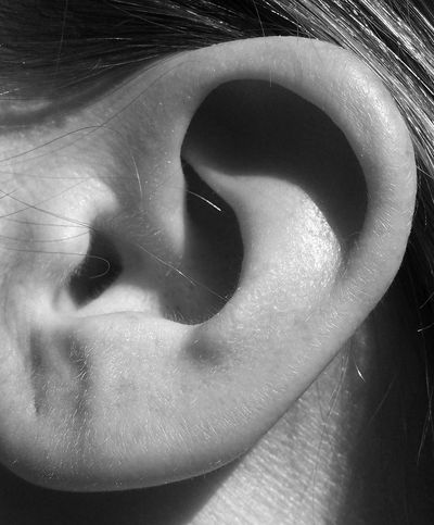 Image of left ear in black and white