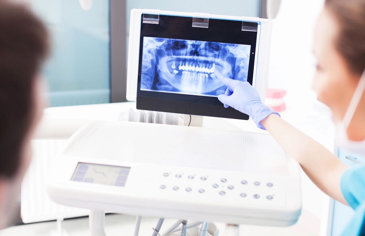 Treatment coordinator reviewing dental x-rays with patient 