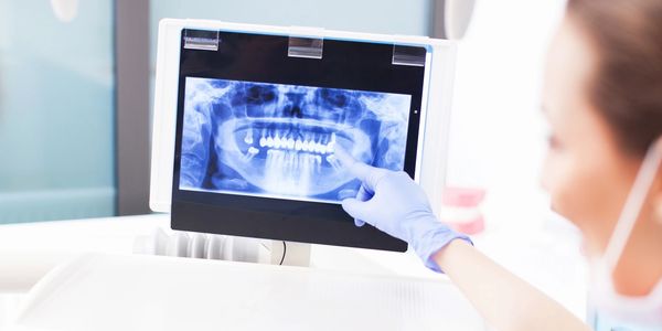 La Clinique Dentaire Couture et Valois à Sorel-Tracy s'occupe de la prise de radiographies.
