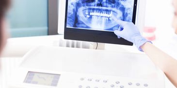 View digital X-rays of your teeth in our massaging dental chairs