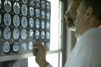 Diffuse Axonal Brain Injury Lawsuits