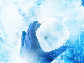 Hand in glove holding a petri dish in a laboratory setting.