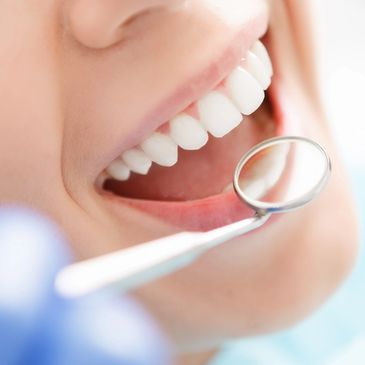 Healthy woman’s teeth and a dental mouth mirror.