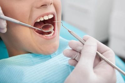 V Family Dentistry - Preventive Services