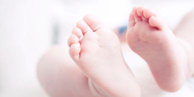 congenital clubfoot