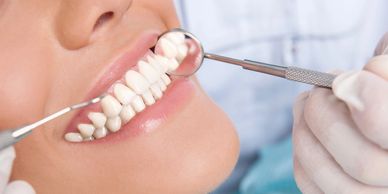 Dentures, false teeth