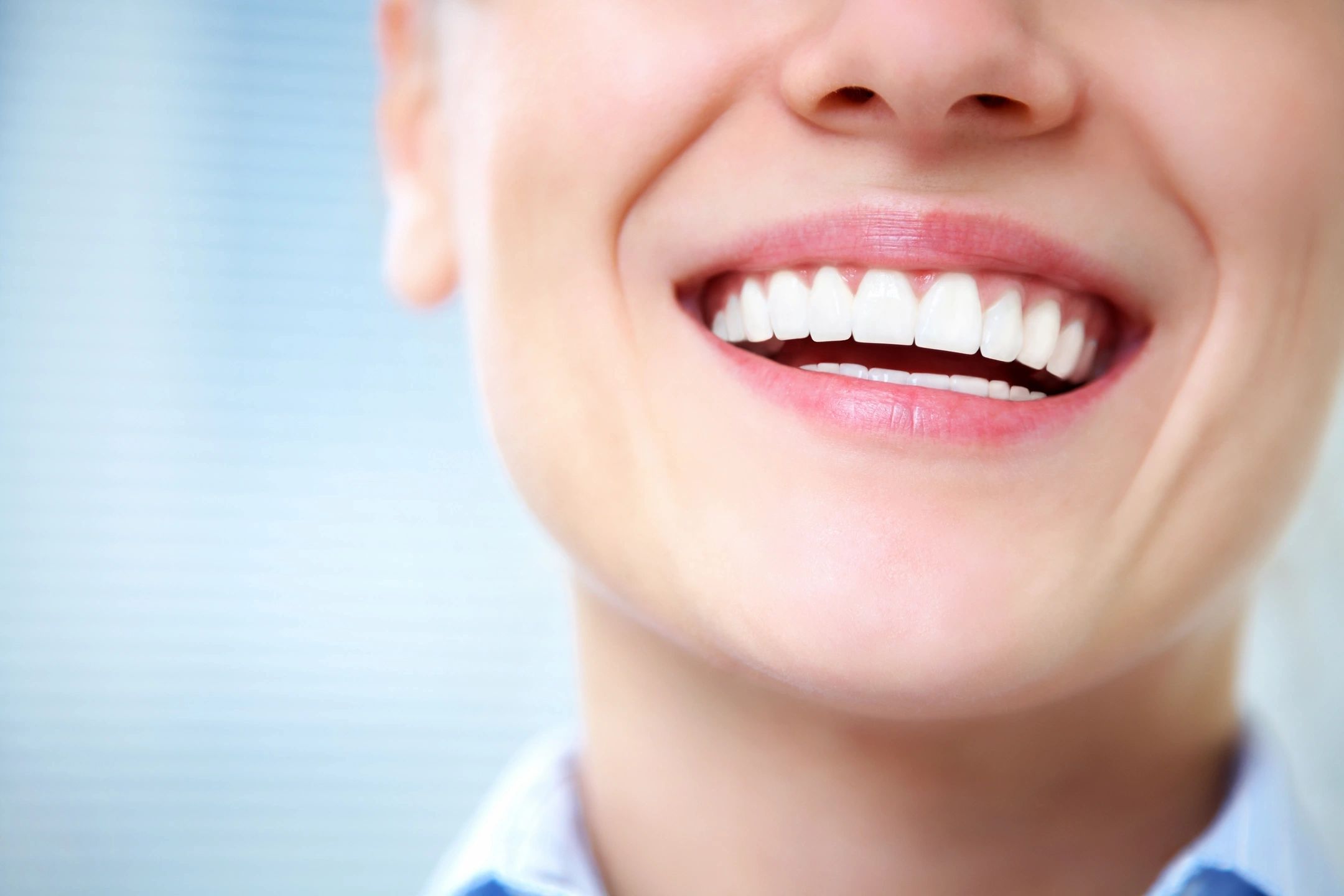 Patient with dental veneers on top and whitening on bottom teeth 