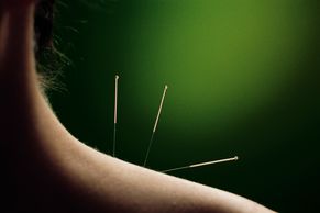 3 acupuncture needles sticking out of top of a shoulder with green background