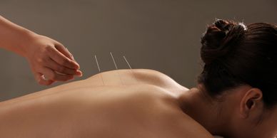 acupuncture for women health, women's health acupuncture