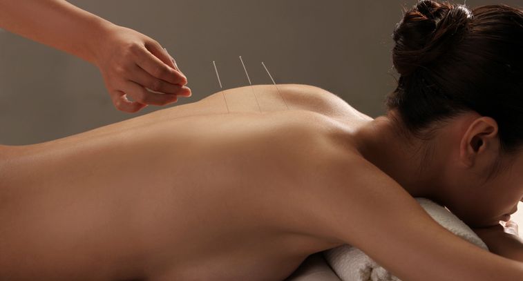 bupa back pain acupuncture