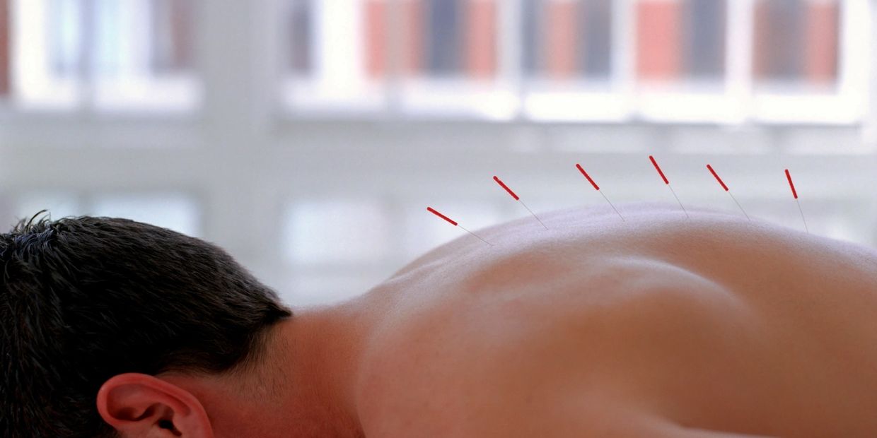 Acupuncture, Chinese Medicine, Holistic Health