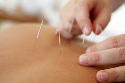 Needling and Massage Therapy