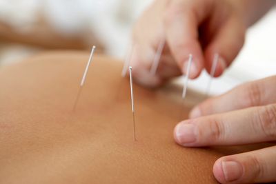 Book Acupuncture, Acupuncture for Fertility or TCM sessions in Oakville, Milton, Waterdown area.
