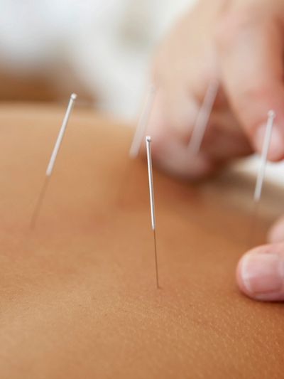 Acupuncture, Female Infertility, East West Natural Health Care, Austin, TX, USA