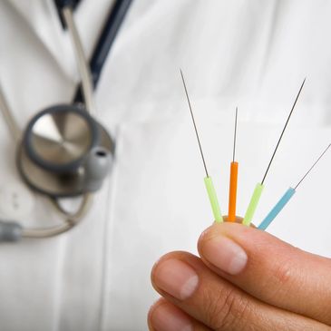 needles, acupuncture, doctor