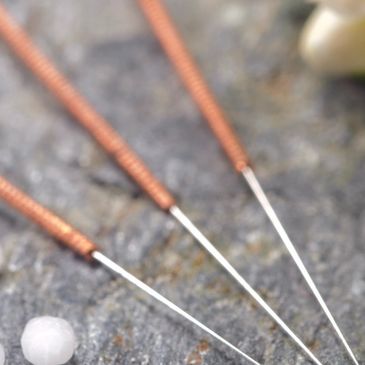 Close up of acupuncture needle handle