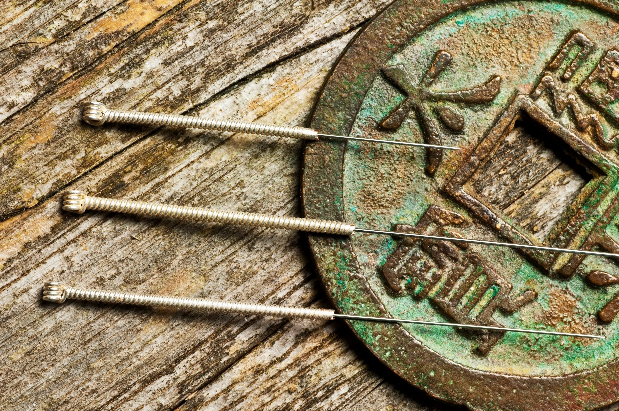 Acupuncture needles next to an old Chinese coin