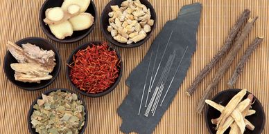 Acupuncture needles and Chinese herbal medicine 