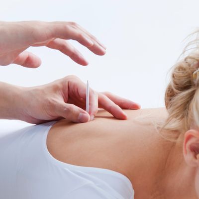 Dry Needling