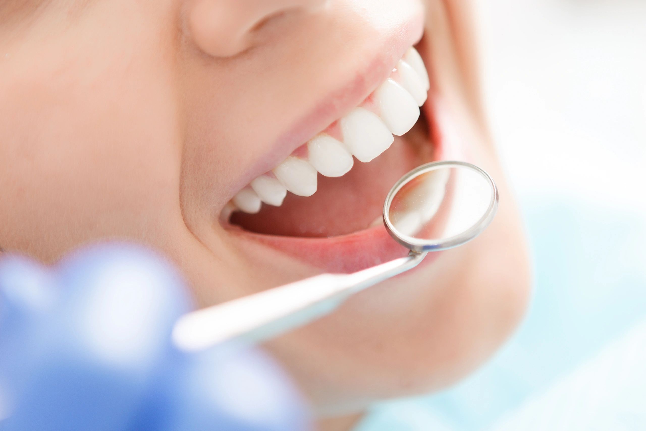 una sonrisa con un espejo dental mirando los dientes