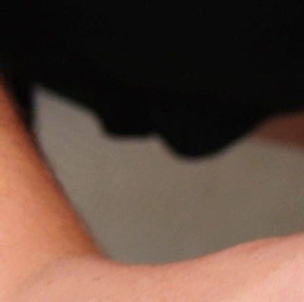 Close-up of a person's arm against a dark background.