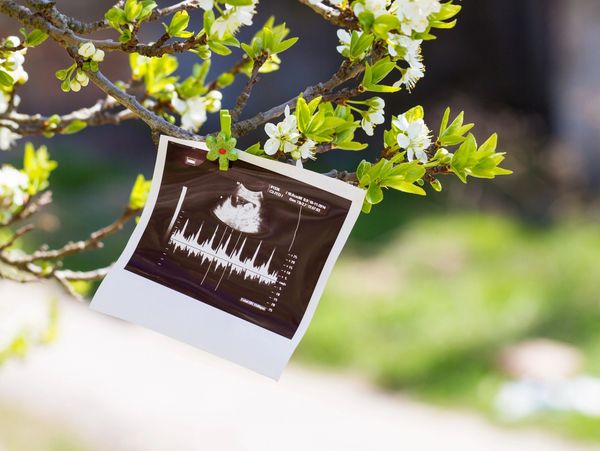 Ultrasound image hanging on a tree outside