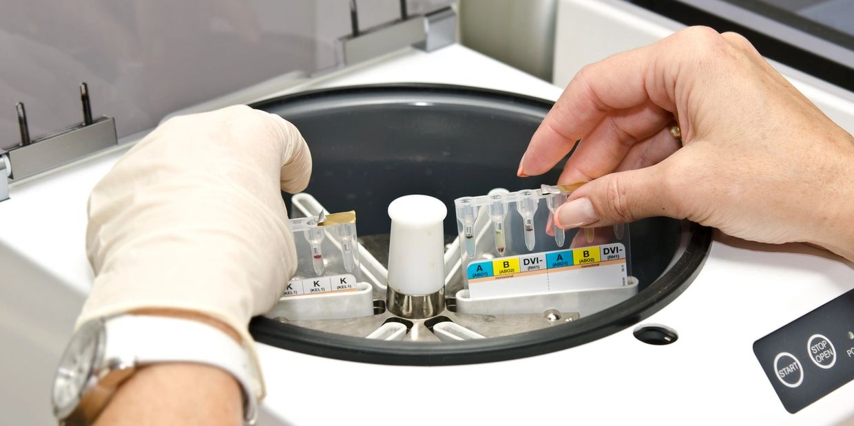 Stay Ready Brighton Aesthetics
PRP & Bio filler Brighton