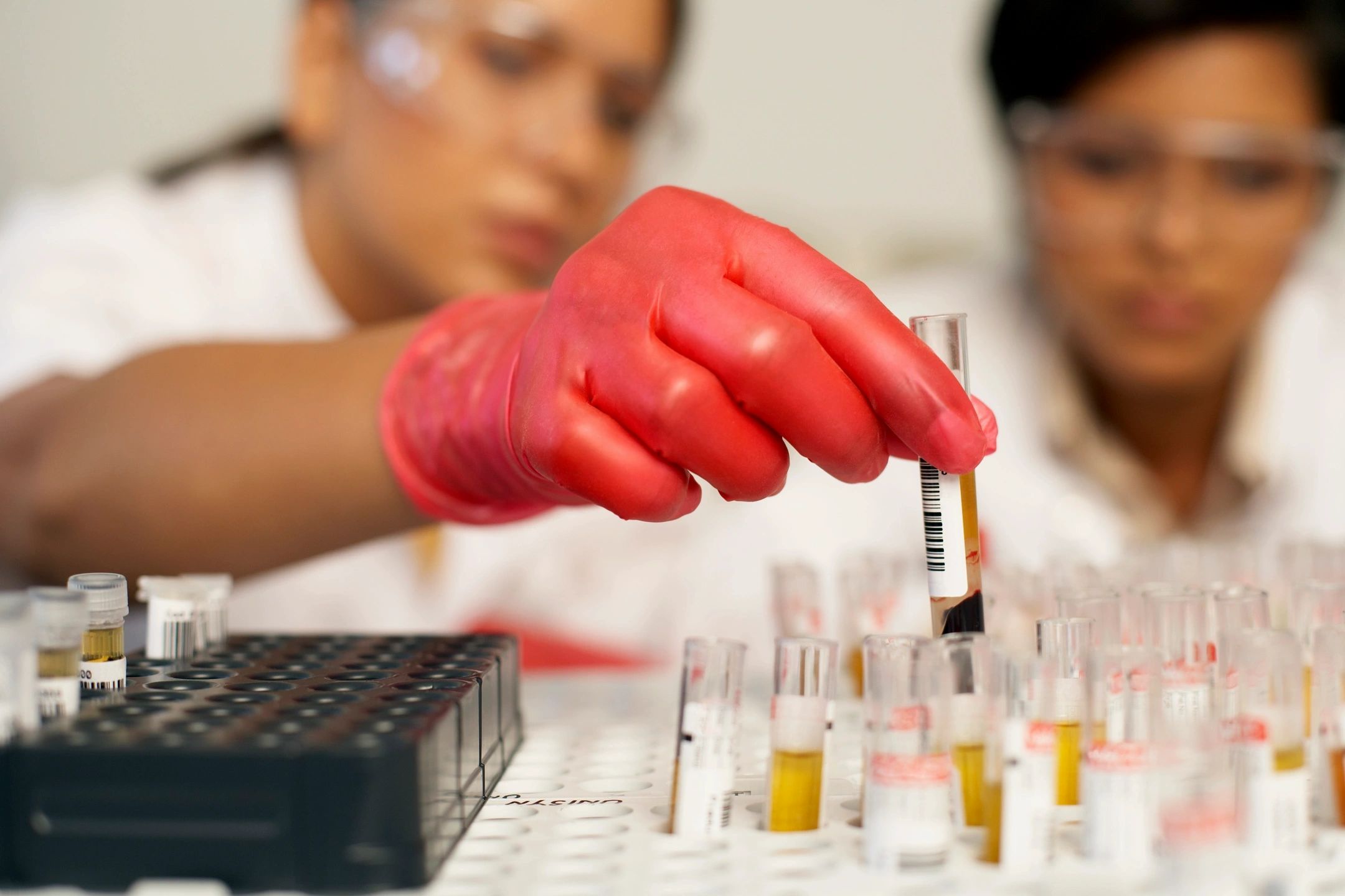 Top Blood Testing Labs for Your Lab Needs